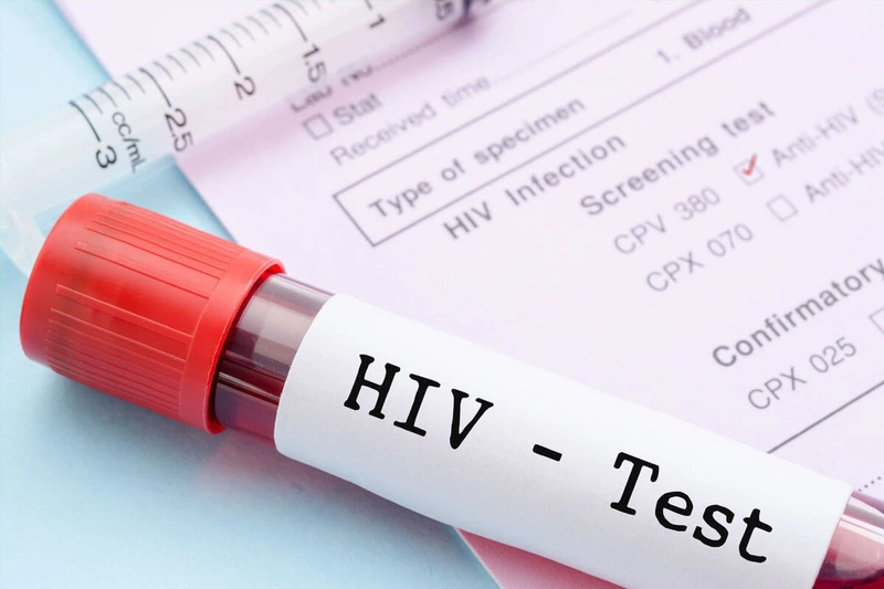 Hướng dẫn sử dụng que test HIV: Những điều bạn chưa biết 1
