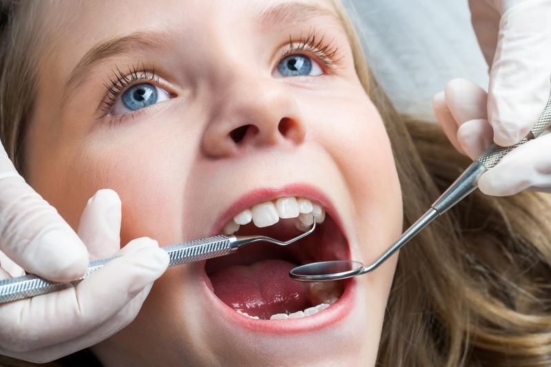 Nên lấy cao răng định kỳ để bảo vệ sức khoẻ răng