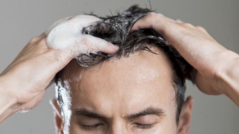 Mách bạn cách chăm sóc da đầu bị khô từ các chuyên gia 3