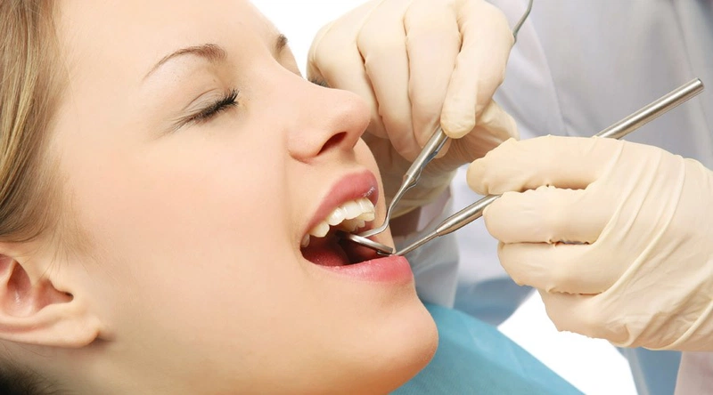 Mức độ nguy hiểm của cao răng độ 3 như thế nào 3