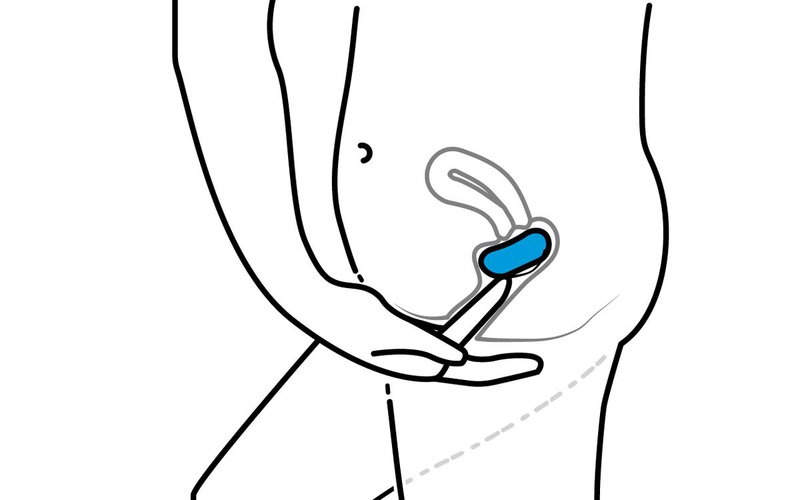 Nhận biết các dấu hiệu bạn nên tháo vòng tránh thai 4