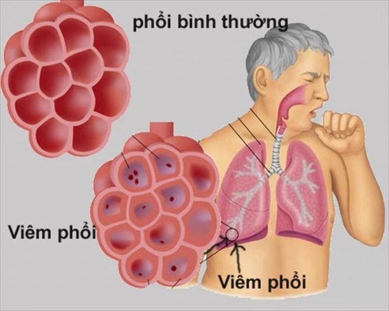 tắm đêm dễ gây các bệnh về đường hô hấp