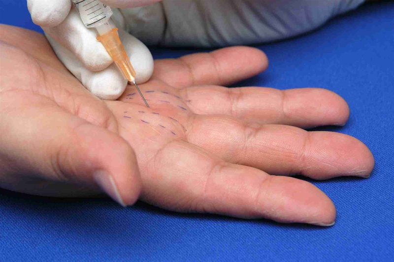 Những điều cần hiểu rõ về tình trạng viêm khớp ngón tay lò xo 2