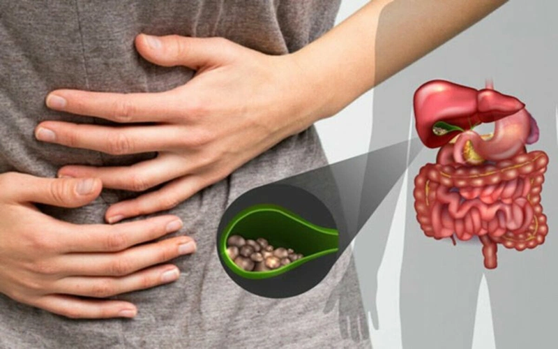Những điều không thể quên khi xây dựng thực đơn ăn kiêng giảm cân cho bệnh nhân đau dạ dày 1