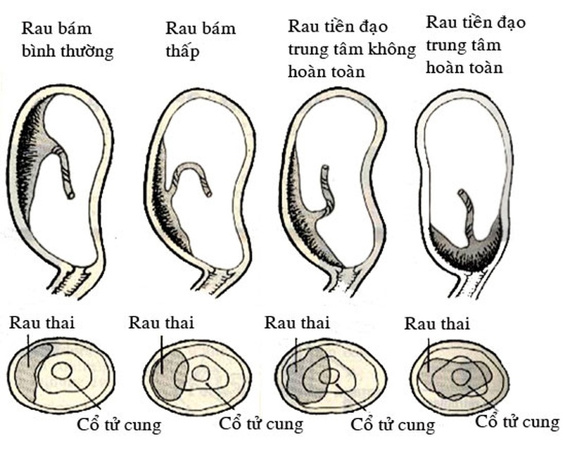 Rau tiền đạo là gì? Liệu có nguy hiểm không? 3