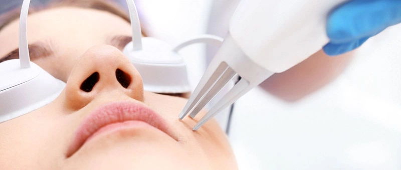 Sẹo lồi có hết được không? 5