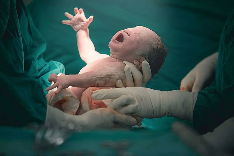 Sinh mổ lần 3 nên mổ ở tuần bao nhiêu? Những điều cần lưu ý khi sinh mổ lần 3 3