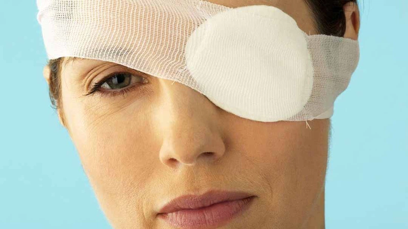 Sụp mí mắt do đâu? Phương pháp điều trị bệnh sụp mí mắt bạn cần biết 2
