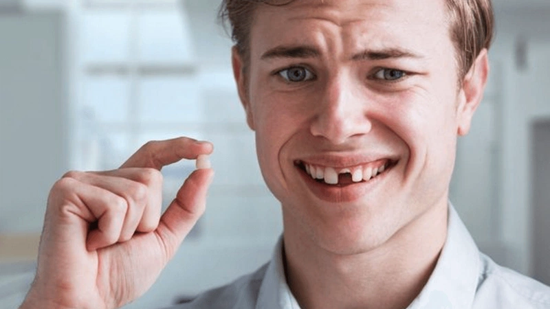 Tác hại của việc lấy cao răng sai cách bạn cần tuyệt đối tránh 1