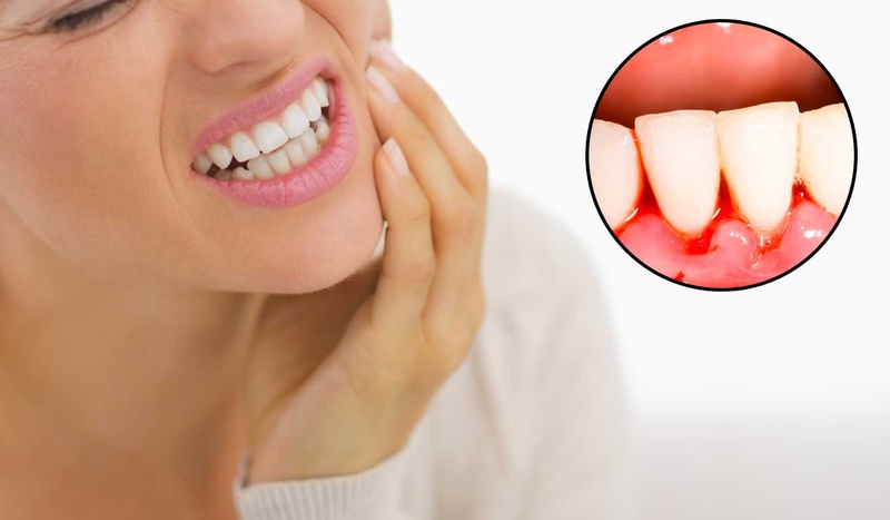 Tại sao nhiều nha sĩ luôn khuyến khích phải lấy cao răng định kỳ 2