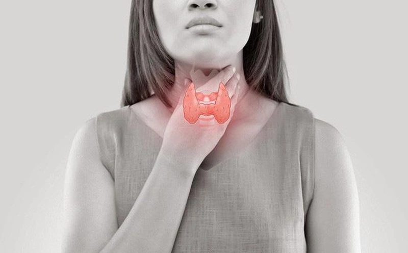 Tất cả thông tin về bướu cổ bên phải mà bạn không thể bỏ lỡ 2