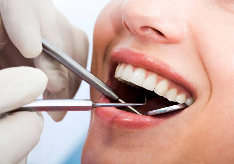Thế nào là cao răng độ 2? Mức độ ảnh hưởng răng miệng ra sao 3