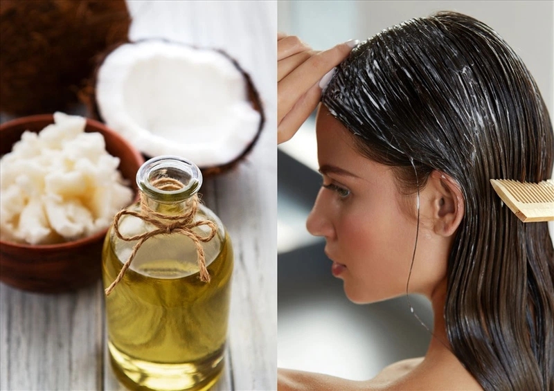 Tóc gàu rụng: Nguyên nhân và cách trị dứt điểm vô cùng đơn giản 2