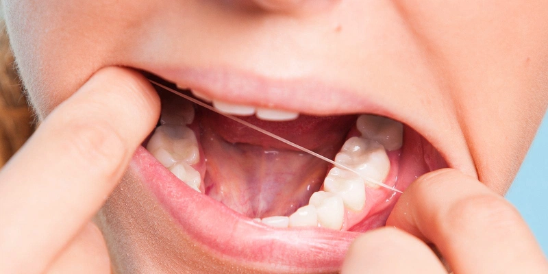 Thường xuyên dùng chỉ nha khoa giúp bạn giữ răng khôn và duy trì sức khỏe răng miệng 3