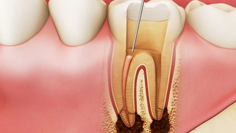 Tình trạng sưng nướu răng và nổi hạch cảnh báo bệnh gì? 4