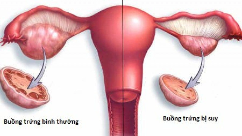 Top 6  thực phẩm giúp chị em bị suy buồng trứng phục hồi khỏe mạnh 1