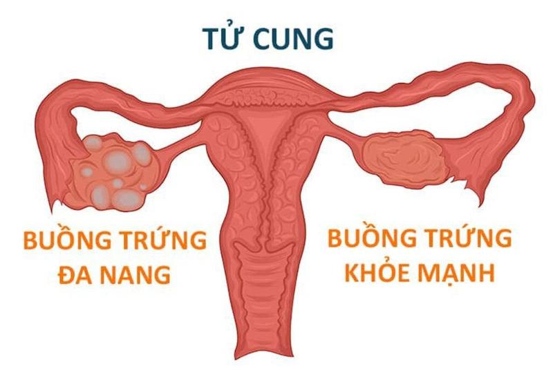 Trễ kinh 7 ngày có sao không? 3