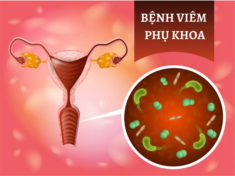 Hướng Dẫn Sử Dụng Thuốc Đặt Phụ Khoa