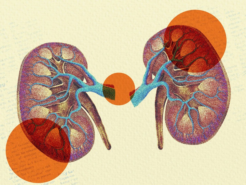 Xét nghiệm ure là gì? Nguyên nhân dẫn tới biến đổi chỉ số ure là gì? 3