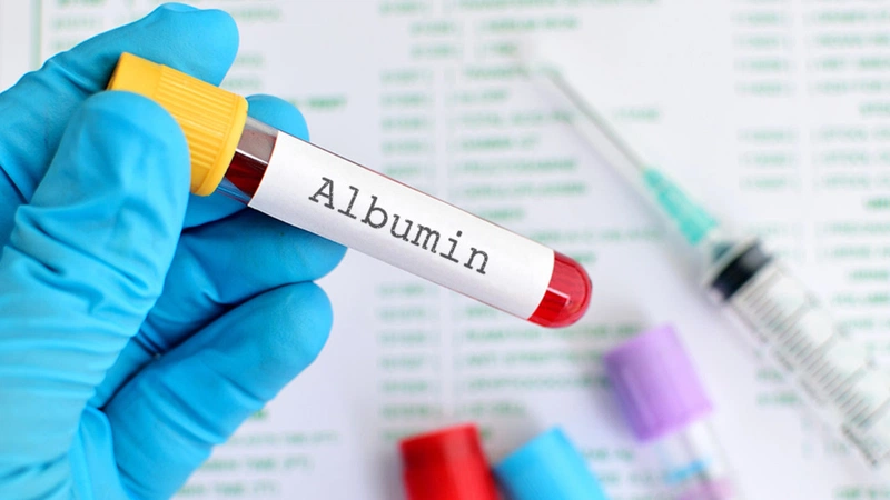 Albumin là gì? Ý nghĩa của xét nghiệm albumin với sức khỏe con người 1