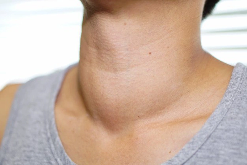 Rau câu có tác dụng tăng cường chức năng tuyển giáp