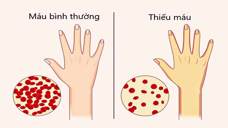 Ăn thịt bò có béo không? Những lợi ích về sức khỏe của việc ăn thịt bò đúng cách 4