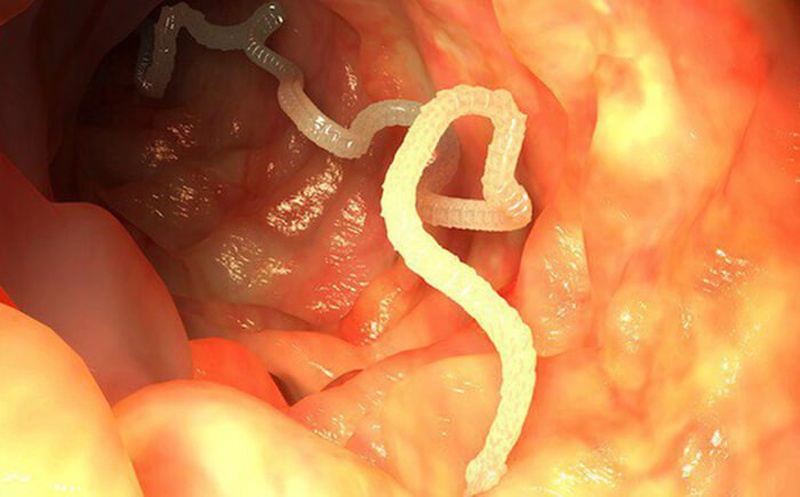 Ăn tiết canh bị sán - Sự thật hay lời đồn? 4