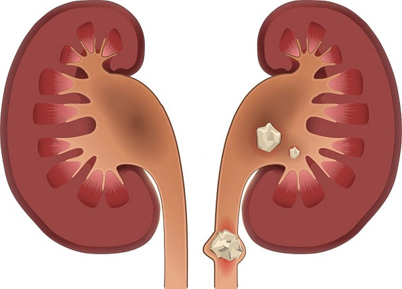 Các bài thuốc dân gian chữa đi tiểu nhiều ai cũng nên biết 2