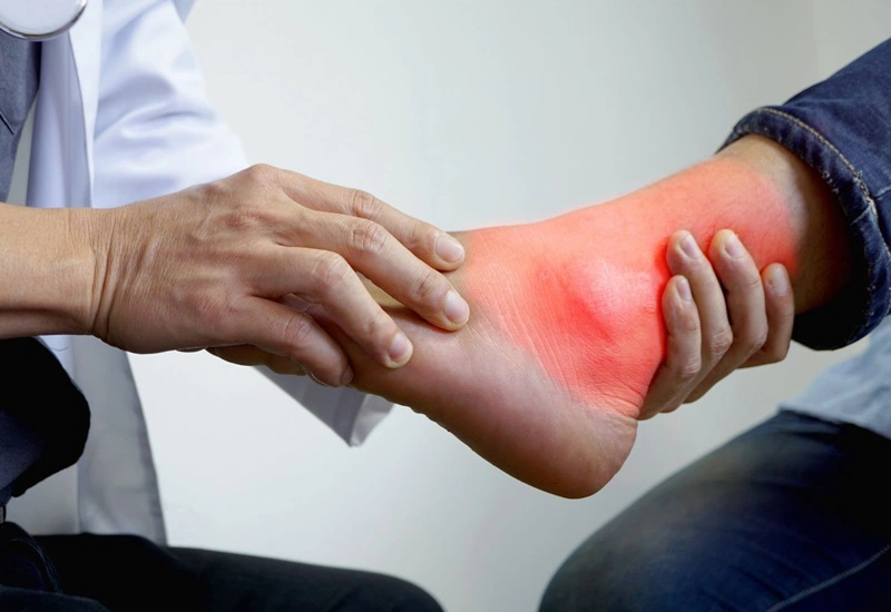Bài thuốc Đông y chữa bệnh gout: Nhanh chóng và hiệu quả 2
