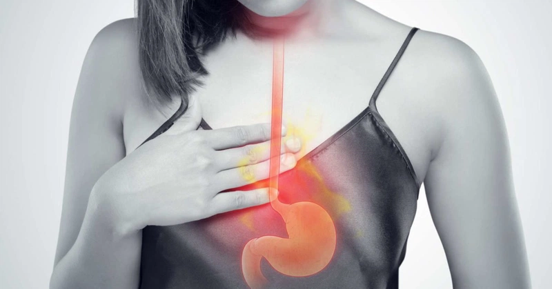 Bấm huyệt nào chữa trào ngược dạ dày đúng cách và hiệu quả?1