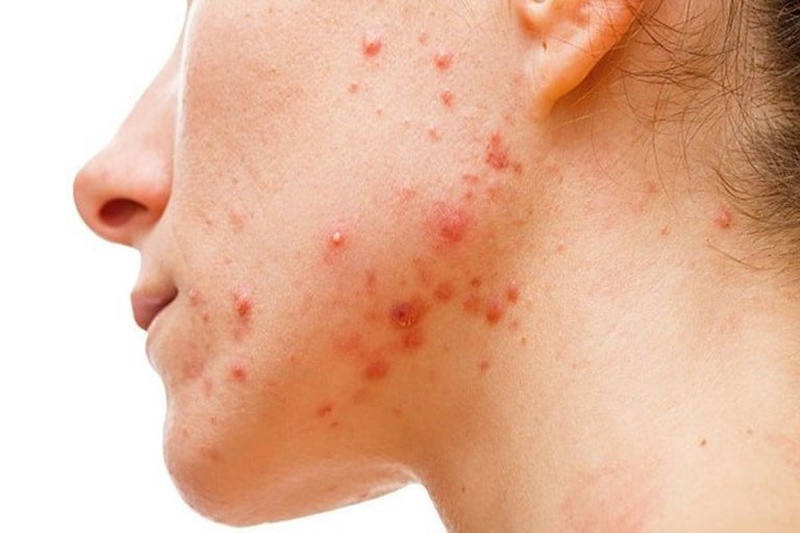 Bạn cần biết: 7 trường hợp không nên sử dụng sữa 1