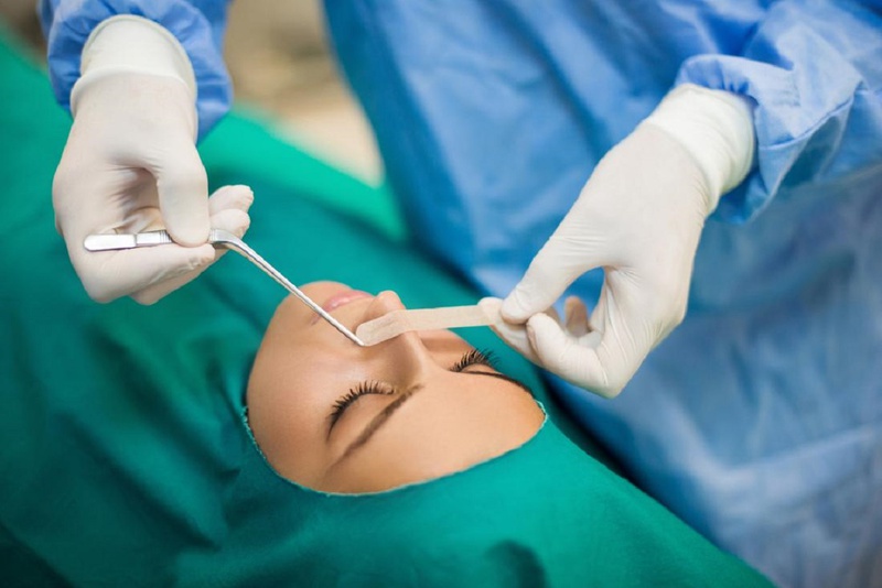 Bạn đã biết các điều trị polyp mũi hiệu quả 3