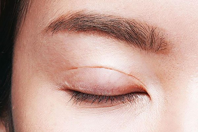 Bạn đã biết cắt mí kiêng thịt gà bao lâu chưa? 2