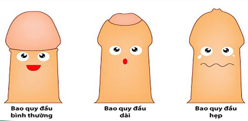 Bao quy đầu dài có ảnh hưởng gì không? 1