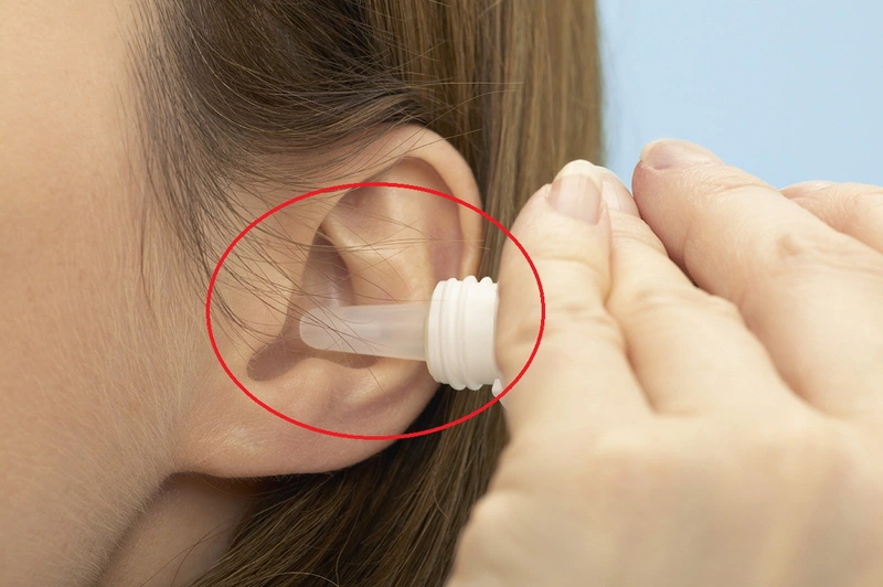 Bật mí phác đồ điều trị nhọt ống tai ngoài hiệu quả và an toàn nhất 3