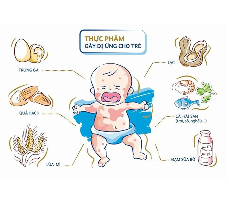 Bé bị phát ban nhưng không sốt có nguy hiểm không và những cách xử lý mẹ cần biết 2
