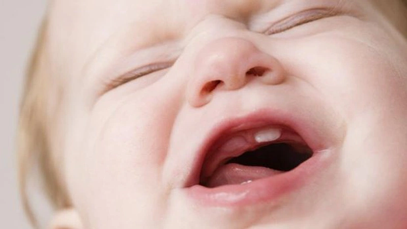 Bé sưng lợi bao lâu thì mọc răng? Dấu hiệu và cách chăm sóc hiệu quả