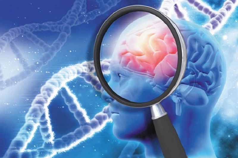 Bệnh alzheimer có di truyền không? Dấu hiệu nhận biết 1