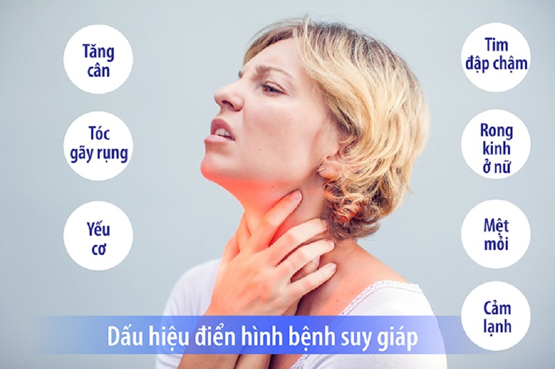 Bệnh bướu cổ suy giáp có chữa được không? 2