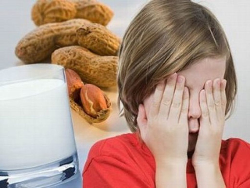 Xử lý trình trạng bệnh dị ứng nặng do đồ ăn như thế nào 1