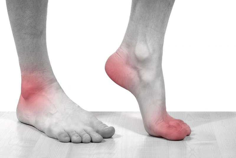 Hiện tượng bị gout và những biến chứng về sau3