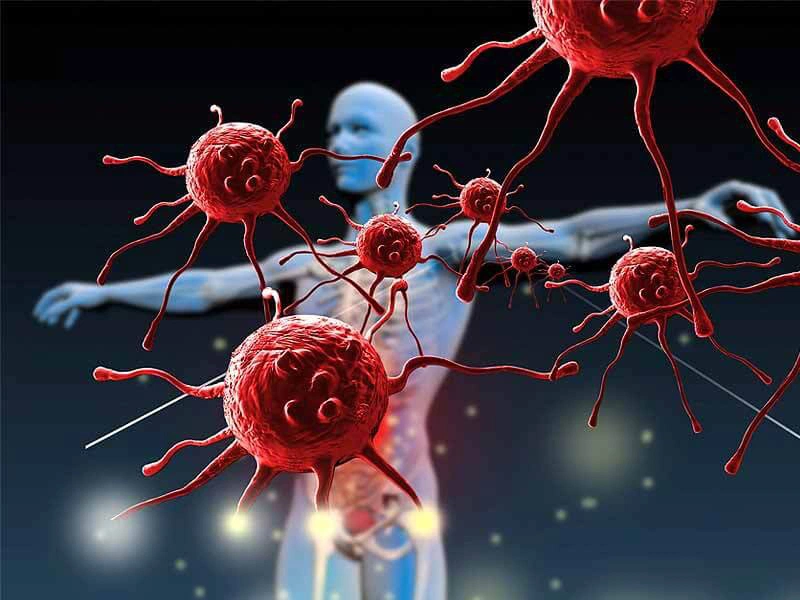 Bệnh lupus ban đỏ có nhổ răng được không? Dấu hiệu nhận biết là gì? 2