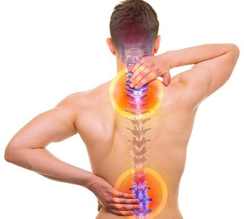 Bệnh lý: Thoái hóa cột sống cổ và thắt lưng1