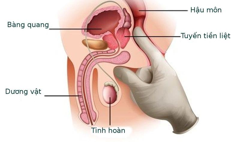 Tìm hiểu chính xác về quan hệ đồng giới nam là như thế nào? 2