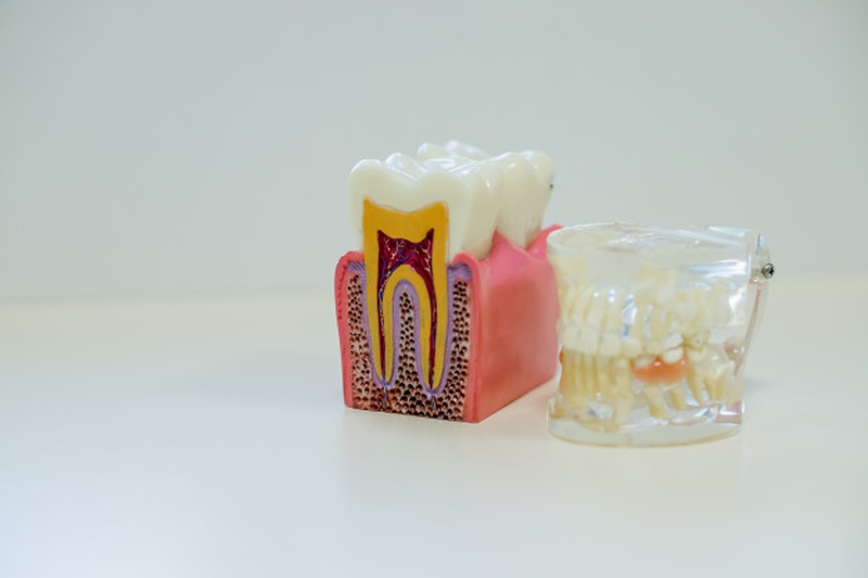 Răng bị nha chu sẽ sưng đỏ vùng nướu xung quanh răng, chảy máu khi có tác động