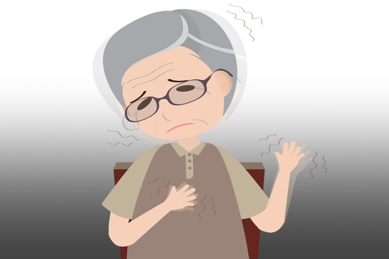 Bệnh Parkinson có mấy giai đoạn và dấu hiệu của từng giai đoạn 1