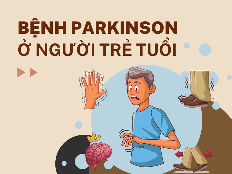 Tổng quan về bệnh Parkinson ở người trẻ 1
