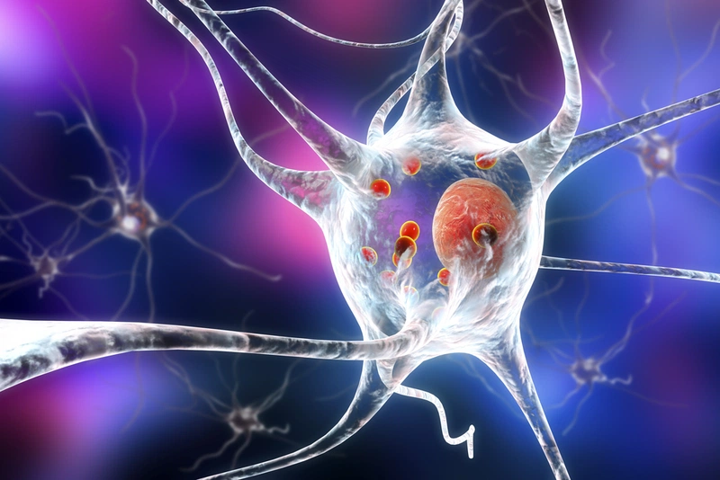 bệnh parkinson ở trẻ em 2
