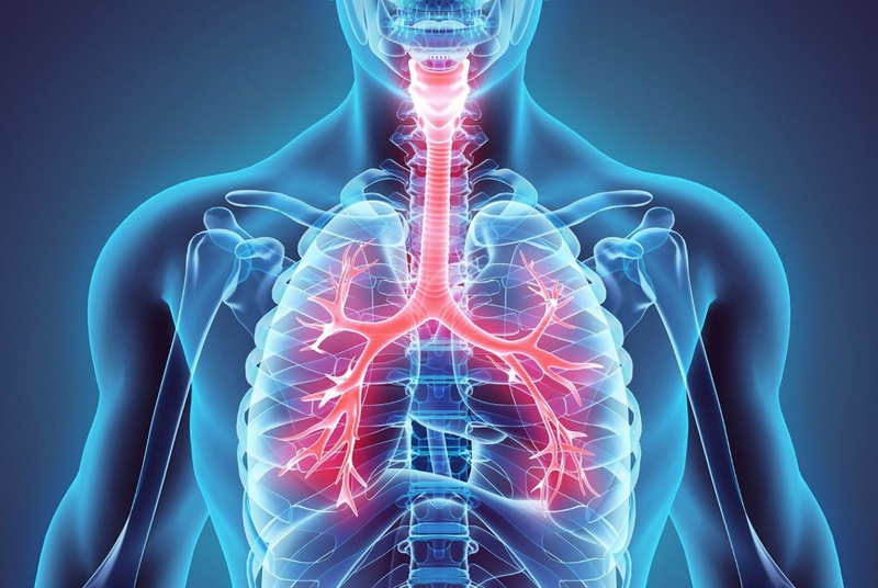 Bệnh phổi tắc nghẽn mạn tính COPD là một bệnh phổi viêm mạn tính gây tắc nghẽn luồng không khí trong phổi