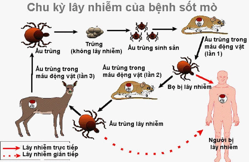 Bệnh sốt mò là gì? Nguyên nhân gây bệnh sốt mò? 2